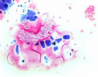 GRAM'S DECOLORIZING SOLUTION FOR THE GRA